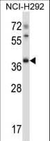 Polyclonal Rabbit anti-Mouse TSSK6 Antibody (aa204-232, WB)