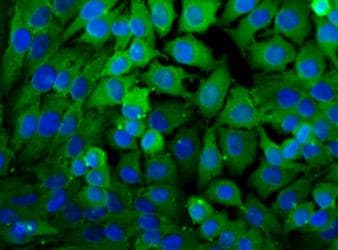 LDHA / LDH1 Antibody (aa280-332, Biotin)