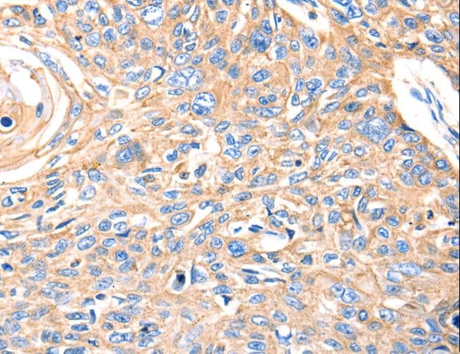 MVP / VAULT1 Antibody