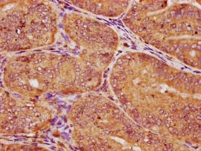 CSNK1E / CK1 Epsilon Antibody