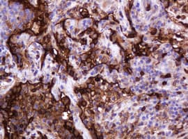 EMA / MUC1 Antibody (clone OTI2E3)