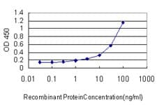 HLA-DMA Antibody (clone 3F12-F11)