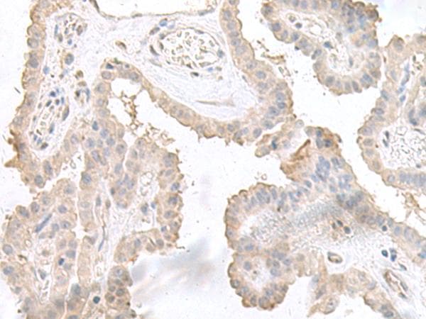 STAU2 Antibody