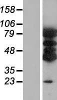 VAC14 / TRX Protein (Over-Expression Lysate Myc-DDK (Flag))