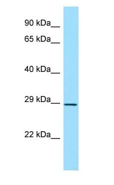 HLA-DPB1 Antibody (aa98-147)