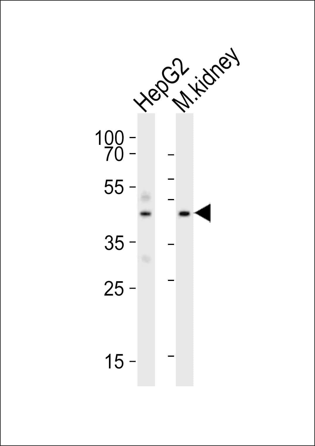 Polyclonal Rabbit anti-Human DNASE1 / DNase I Antibody (aa87-121, WB)