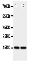 E-FABP / FABP5 Antibody (aa10-23)