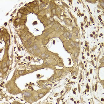 Polyclonal Rabbit anti-Human ACTR2 / ARP2 Antibody (IHC, IF, WB)