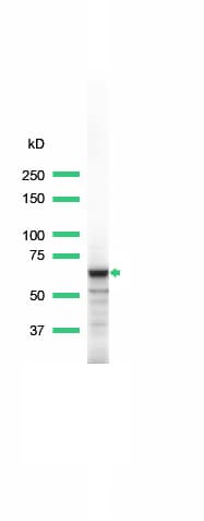 IHC-plus™ Polyclonal Rabbit anti-Human SYK Antibody (aa313-339, IHC, WB)