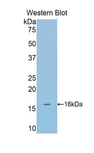 Tryptase Antibody (aa149-273)