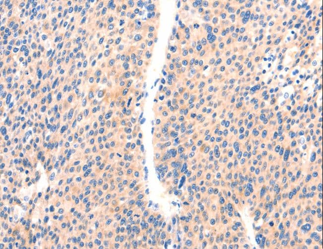 PAFAH2 Antibody