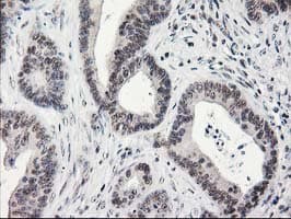 ADH2 / ADH1B Antibody (clone OTI4F12)