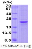 Human FOPNL Protein (Recombinant His)