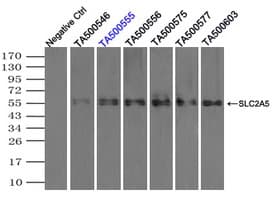 SLC2A5 / GLUT5 Antibody (clone OTI9H4)