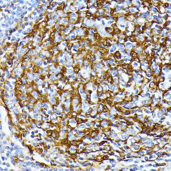 CSNK1A1 / CK1 Alpha Antibody