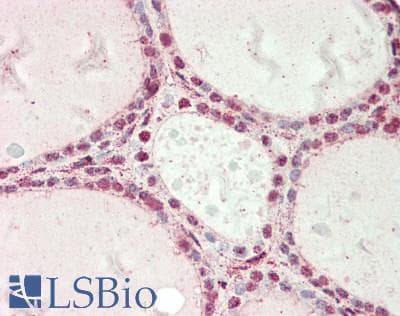 IHC-plus™ EED Antibody