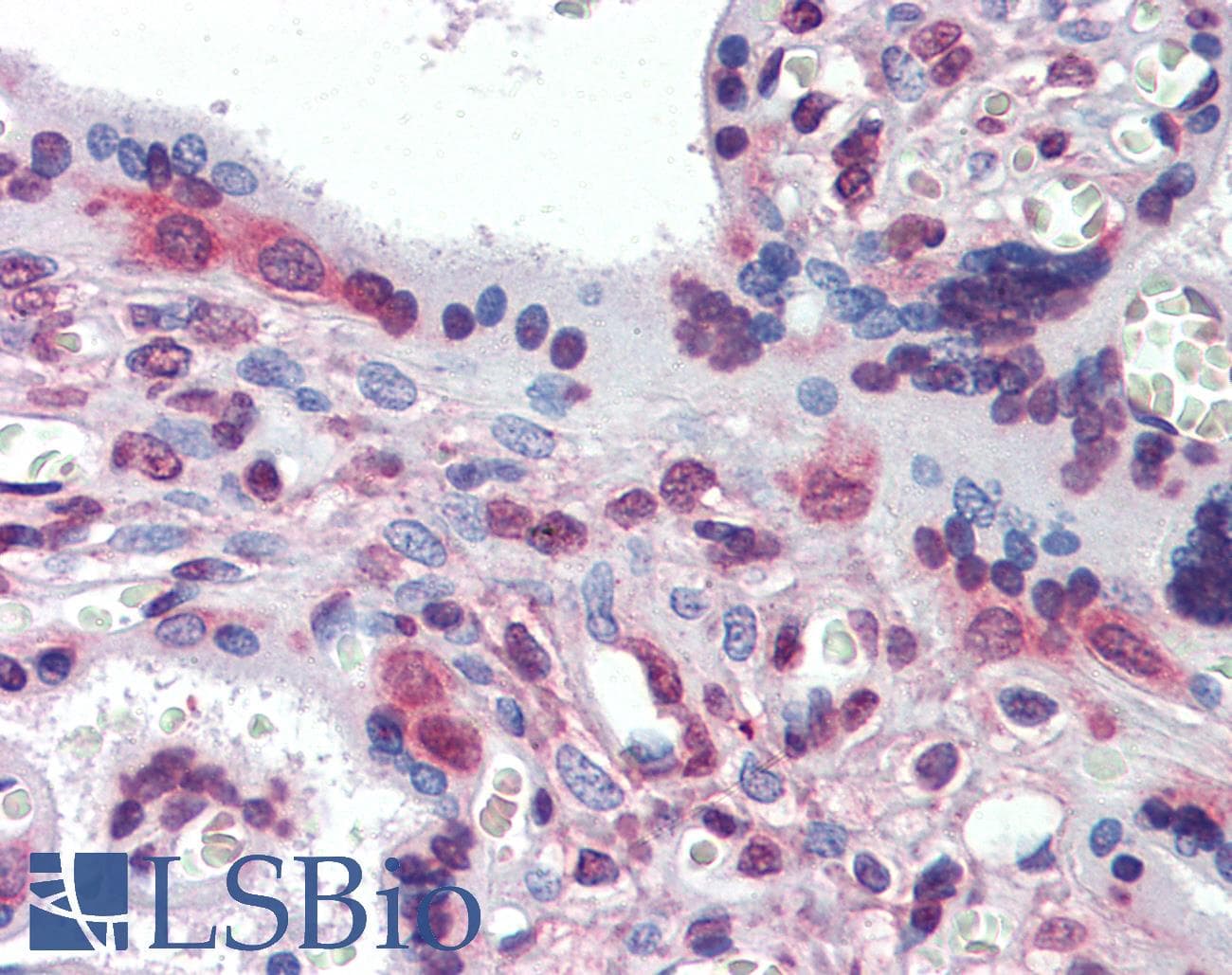 IHC-plus™ PEA3 / ETV4 Antibody (clone 1A2G3)