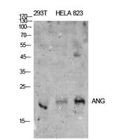 Polyclonal Rabbit anti-Human Angiogenin / ANG Antibody (WB)