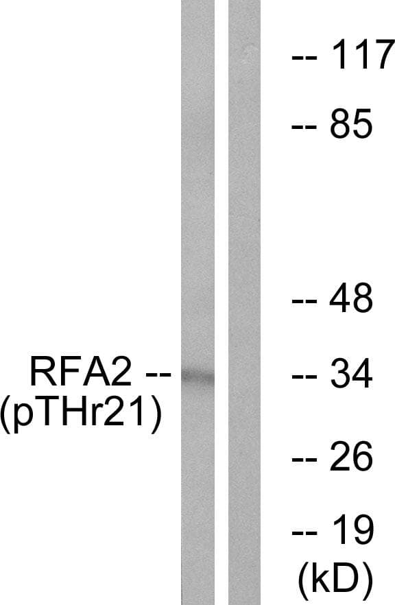 RPA2 / RFA2 / RPA34 Antibody (phospho-Thr21)