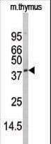 DRAK1 / STK17A Antibody (aa1-30)