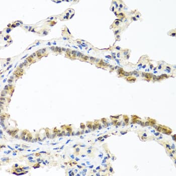 RAC2 Antibody