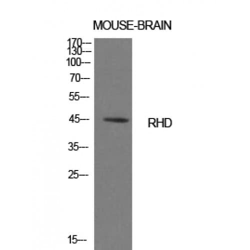 Polyclonal Rabbit anti-Human RHD Antibody (161-210 aa, Internal, WB)