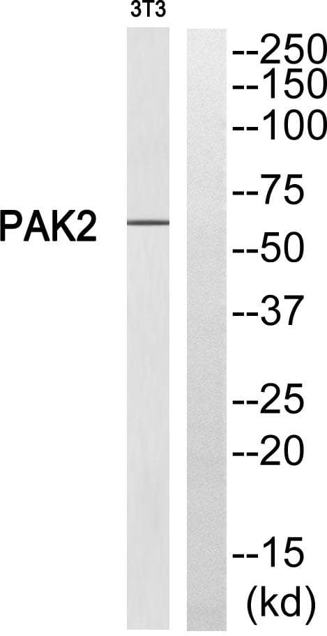 Polyclonal Rabbit anti-Human PAK2 Antibody (p20, IHC, WB)