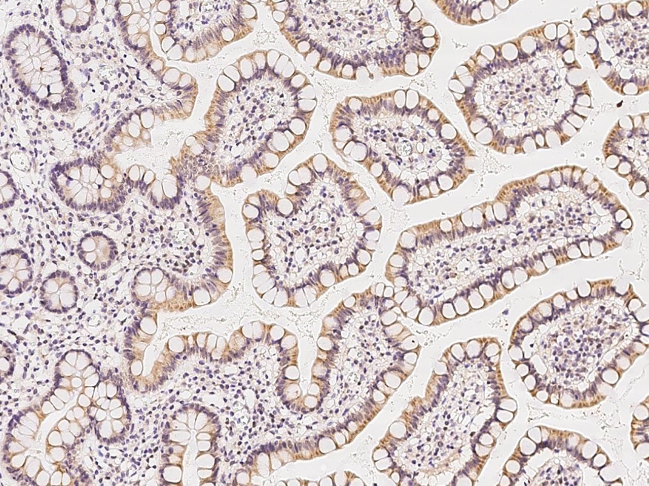 GRAMD3 Antibody