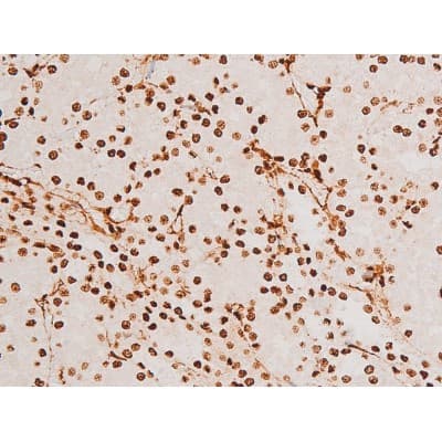 Polyclonal Rabbit anti-Human SYK Antibody (phospho-Tyr348, IHC, IF, WB)