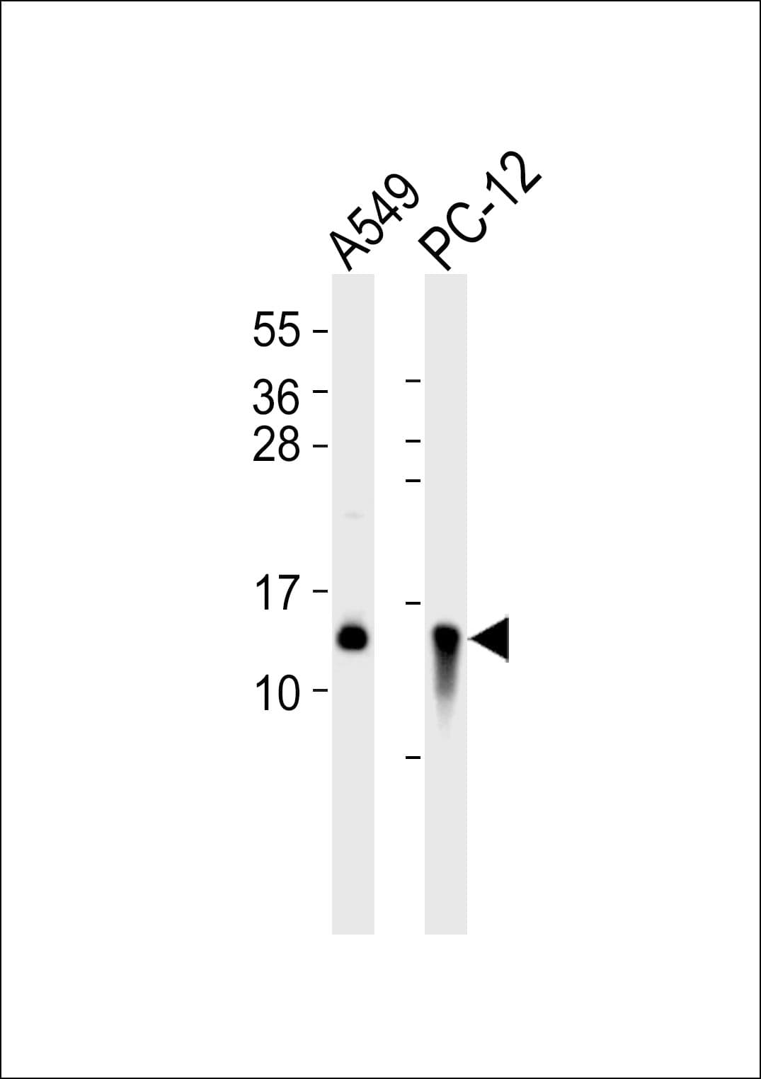 CSTB / Cystatin B / Stefin B Antibody