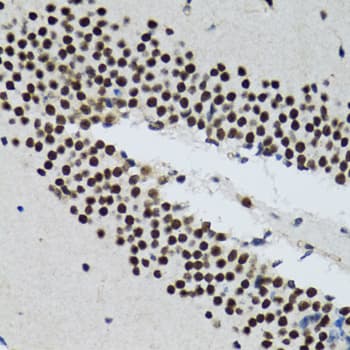 TRP32 / TXNL1 Antibody