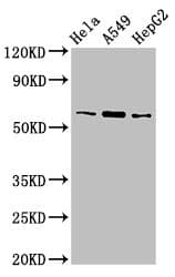 TBL1X / TBL1 Antibody