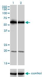 PIKFYVE / PIP5K Antibody (clone 6C7)