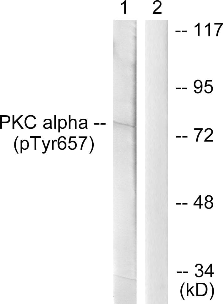 PRKCA / PKC-Alpha Antibody (phospho-Tyr657)
