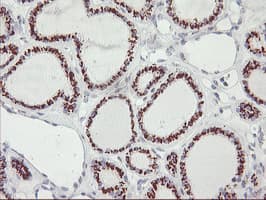 GOLM1 / GP73 / GOLPH2 Antibody (clone OTI3D7)