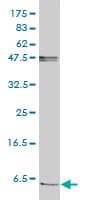 Monoclonal Mouse anti-Human FXYD2 Antibody (clone 1C3-B3, IHC, WB)