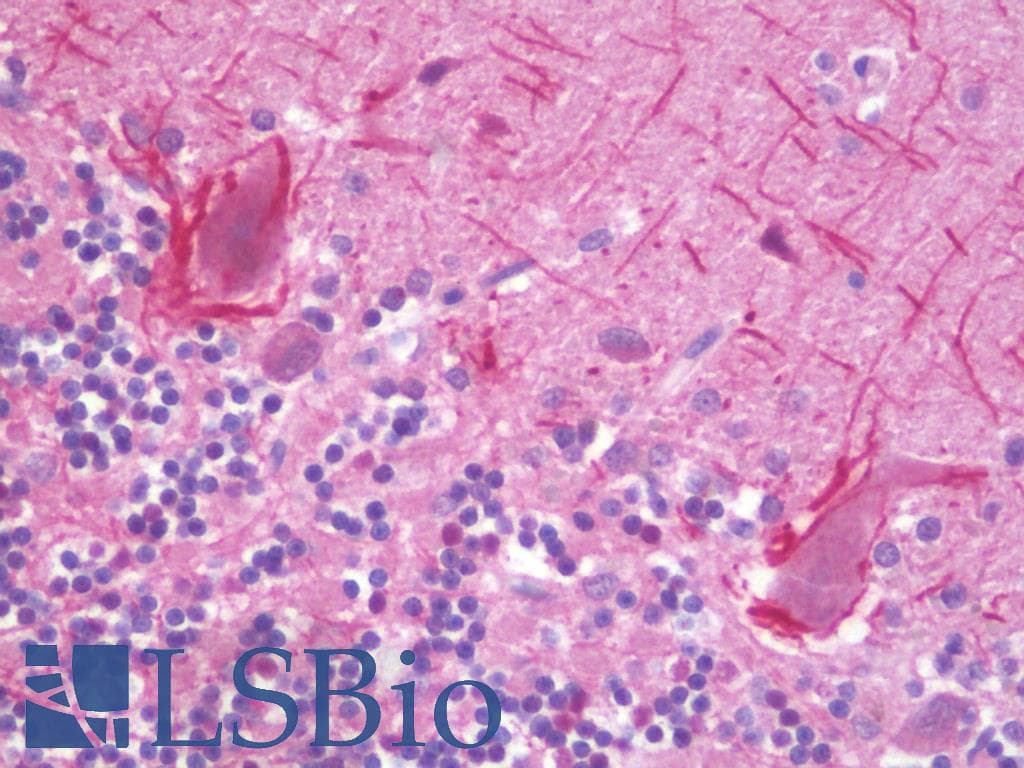 IHC-plus™ BPIFA2 / SPLUNC2 Antibody (clone 1F12)