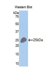 ITLN1 / Omentin Antibody (aa101-292)