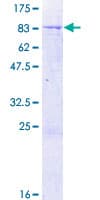 Human ALDH5A1 Protein (Recombinant GST)