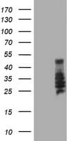 Monoclonal Mouse anti-Human SERPINB2 / PAI-2 Antibody (clone OTI3H1, IHC, WB)