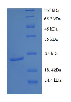 Mouse EFNB3 / Ephrin B3 Protein (Recombinant His)