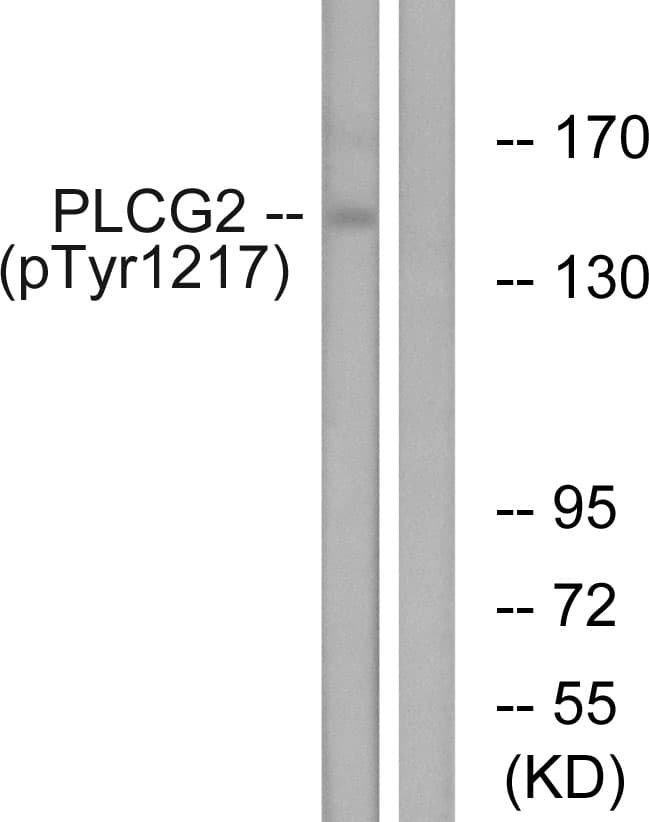 PLCG2 / PLC Gamma 2 Antibody (phospho-Tyr1217)