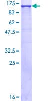 Human XPO1 / CRM1 Protein (Recombinant GST)
