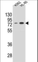 Polyclonal Rabbit anti-Human ENTPD3 Antibody (aa496-527, IHC, WB)