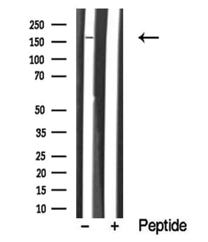 LTK Antibody