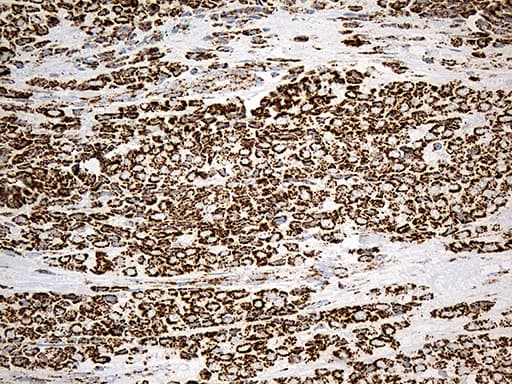 Monoclonal Mouse anti-Human MCAD / ACADM Antibody (clone OTI9G10, IHC, WB)