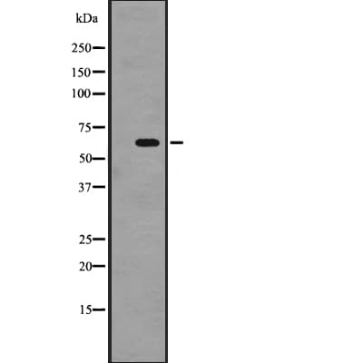 SRMS Antibody