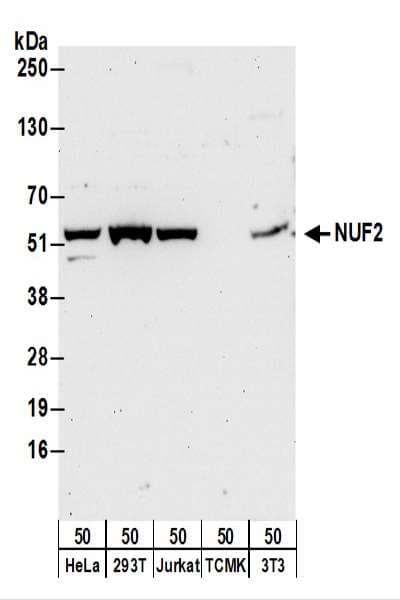 CDCA1 / NUF2 Antibody (aa414-464)