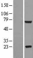 GLB1L2 Protein (Over-Expression Lysate Myc-DDK (Flag))
