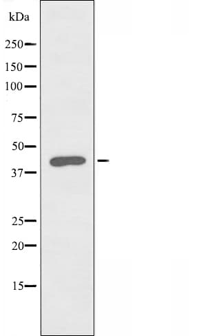PRKAR1B Antibody